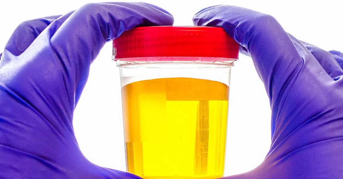Your body's hydration indicator! Learn how to monitor your urine color for better health. Discover the secrets it holds about your hydration status.